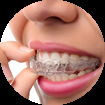 invisalign-clear-orthodontics