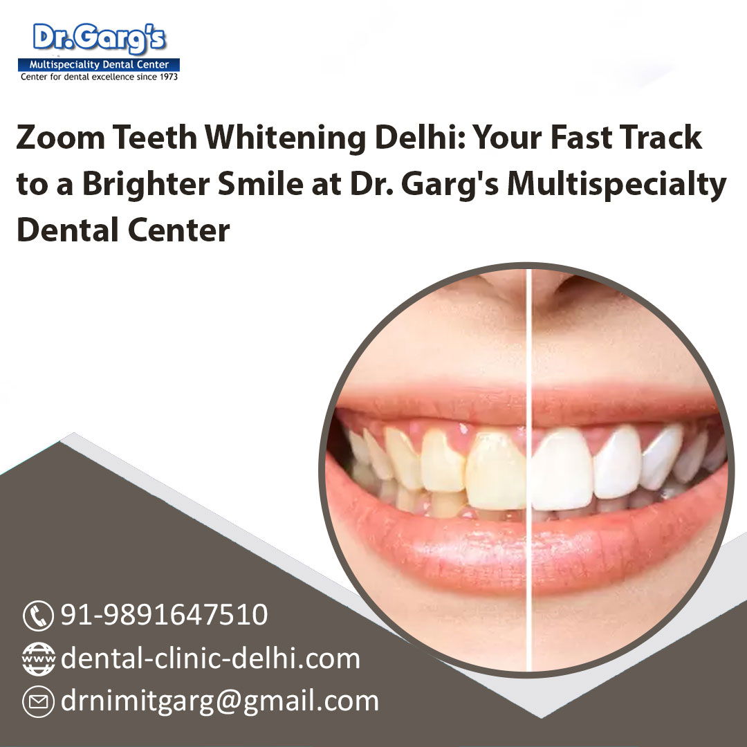 teeth whitening price in Delhi