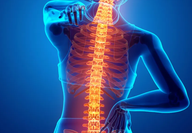 ankylosing spondylitis disability