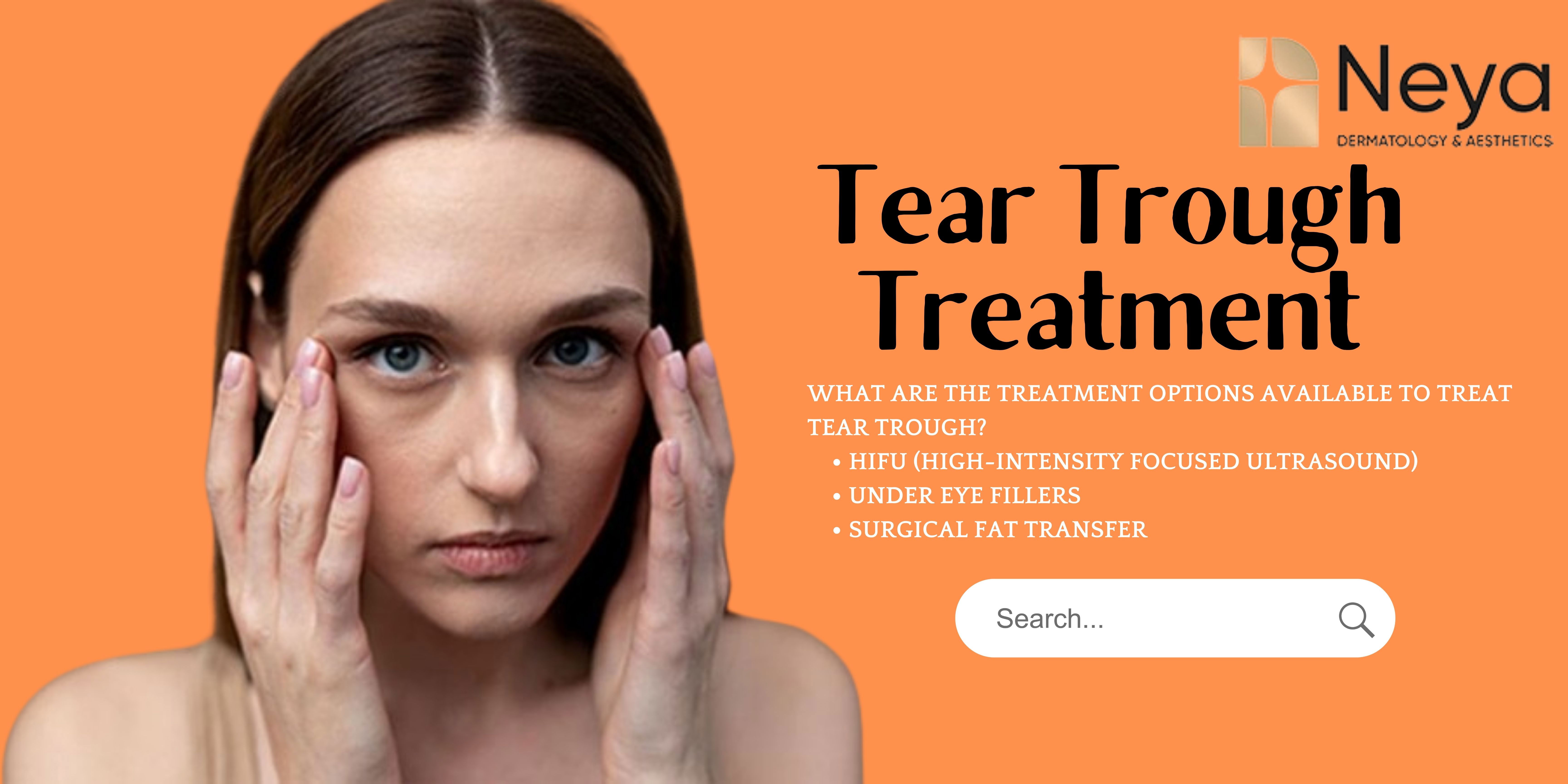 Tear Trough Fillers