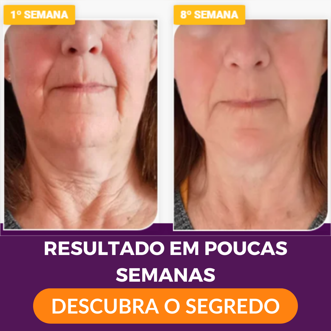 Dream Colágeno Solúvel antes e depois