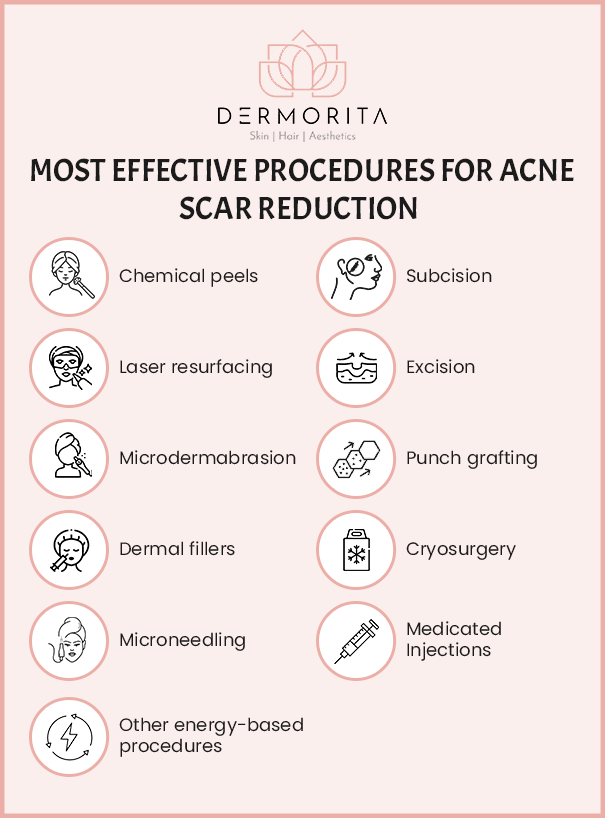 best facial acne scar treatments