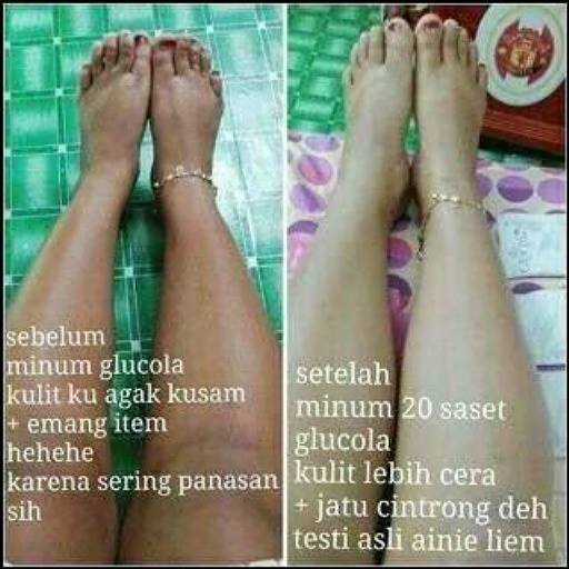 Gambar terkait
