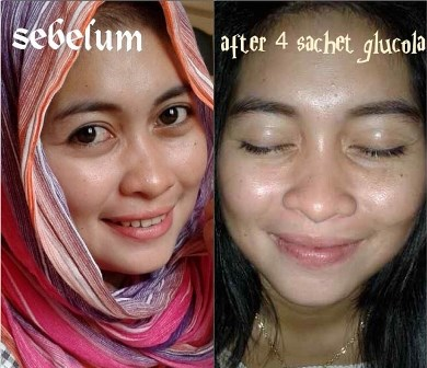 Image result for testimoni glucola stevia