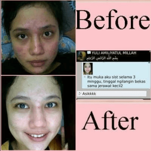 Bio Oil