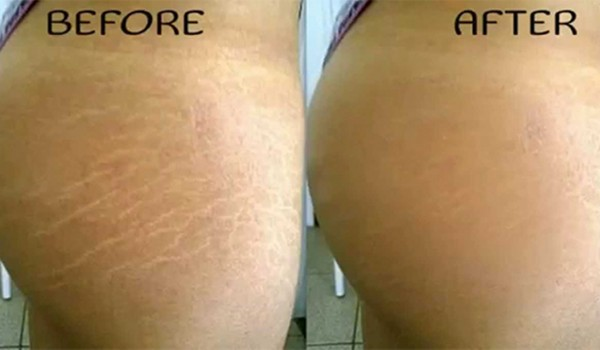 Bio Oil