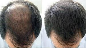 Image result for CABOKI